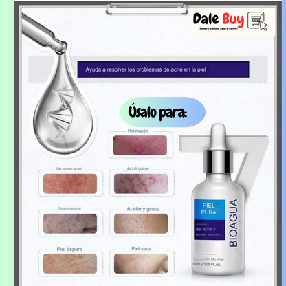 COMBO ANTI ACNE BIOAQUA 4 PRODUCTOS